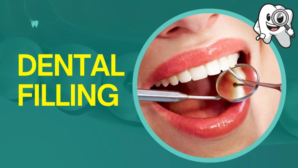 Dental Filling